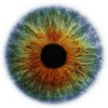 cataracta