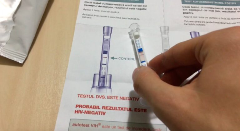 test hiv autoadministrabil